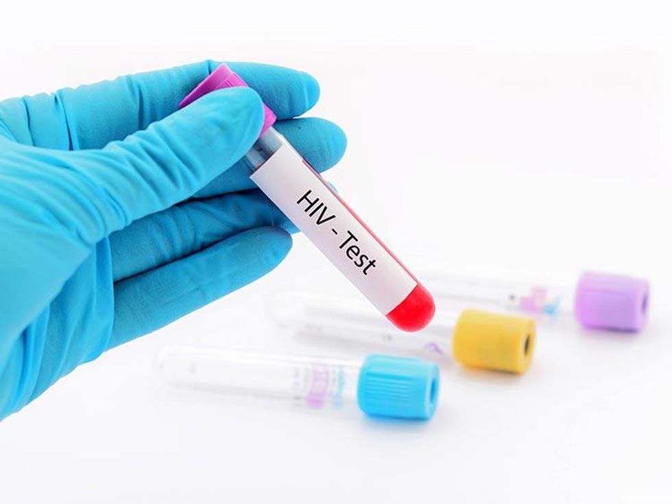 1. I just tested positive for HIV. Could it be a mistake?