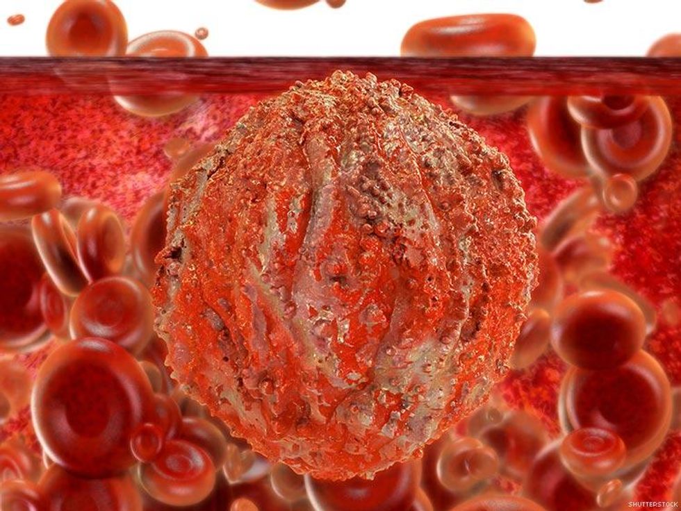 14. What is \u201cTreatment as Prevention?\u201d