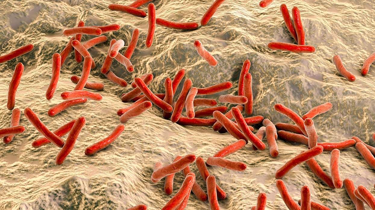 Go to Central Florida, Get Leprosy