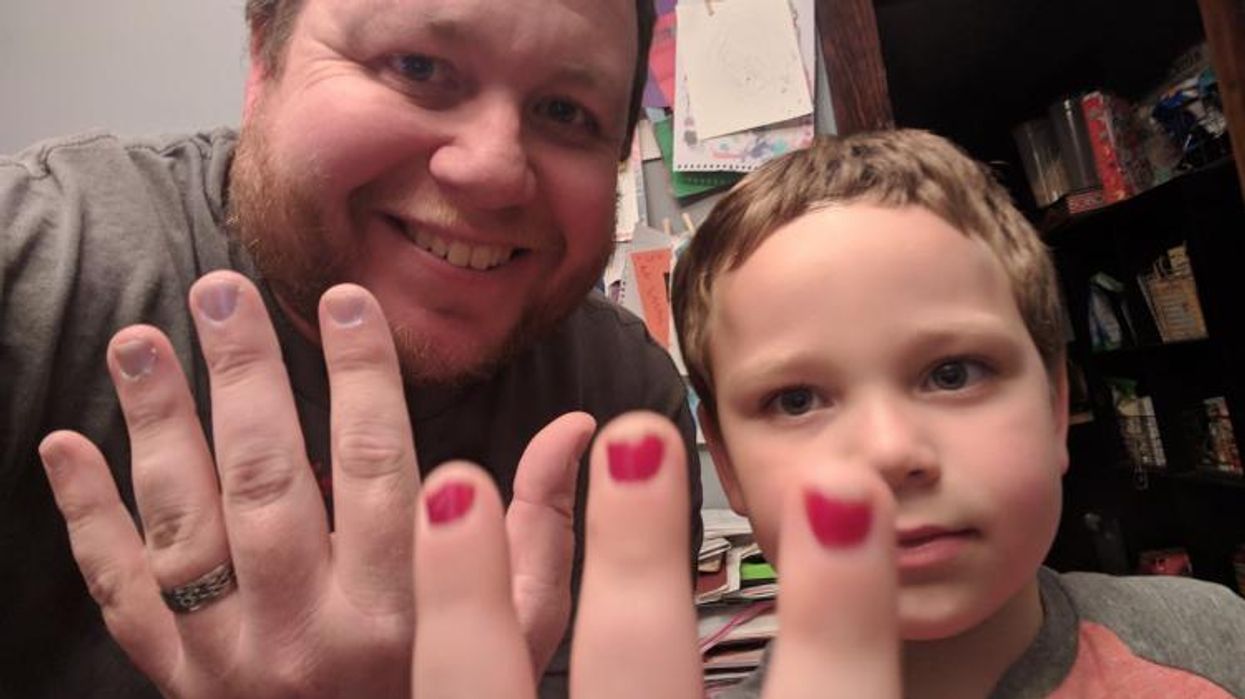 <p>Dad Paints Nails to Support His Son Who Got Bullied</p>