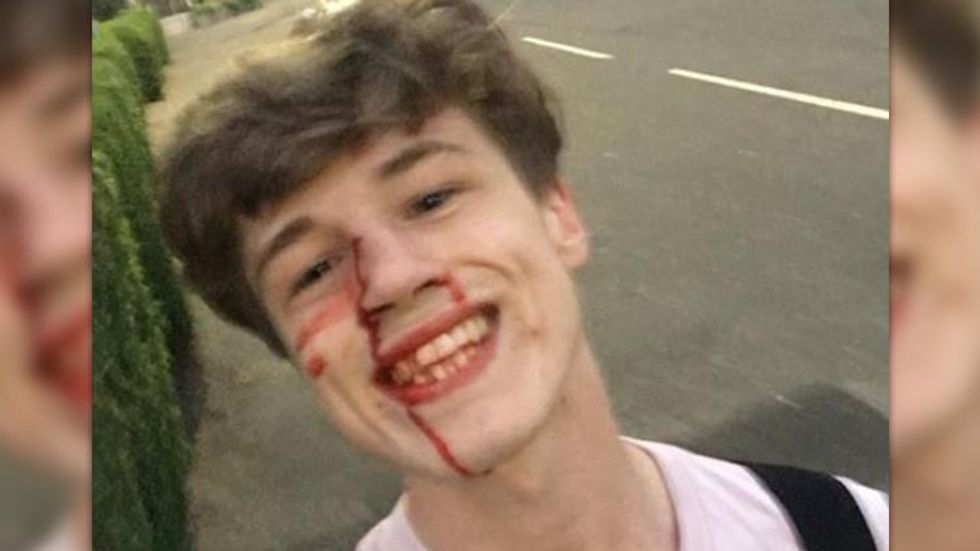 Man Attacked for Being Gay Goes Viral After Posting Grinning Selfie