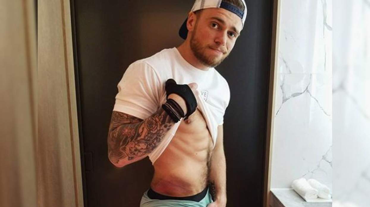 <p>Ouch! Olympian Gus Kenworthy Shows Off His Bruised Peach on Instagram</p>