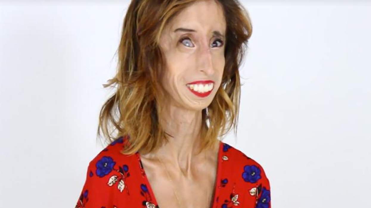 <p>Lizzie Velasquez Proves We Have It All Wrong When It Comes to Beauty</p>