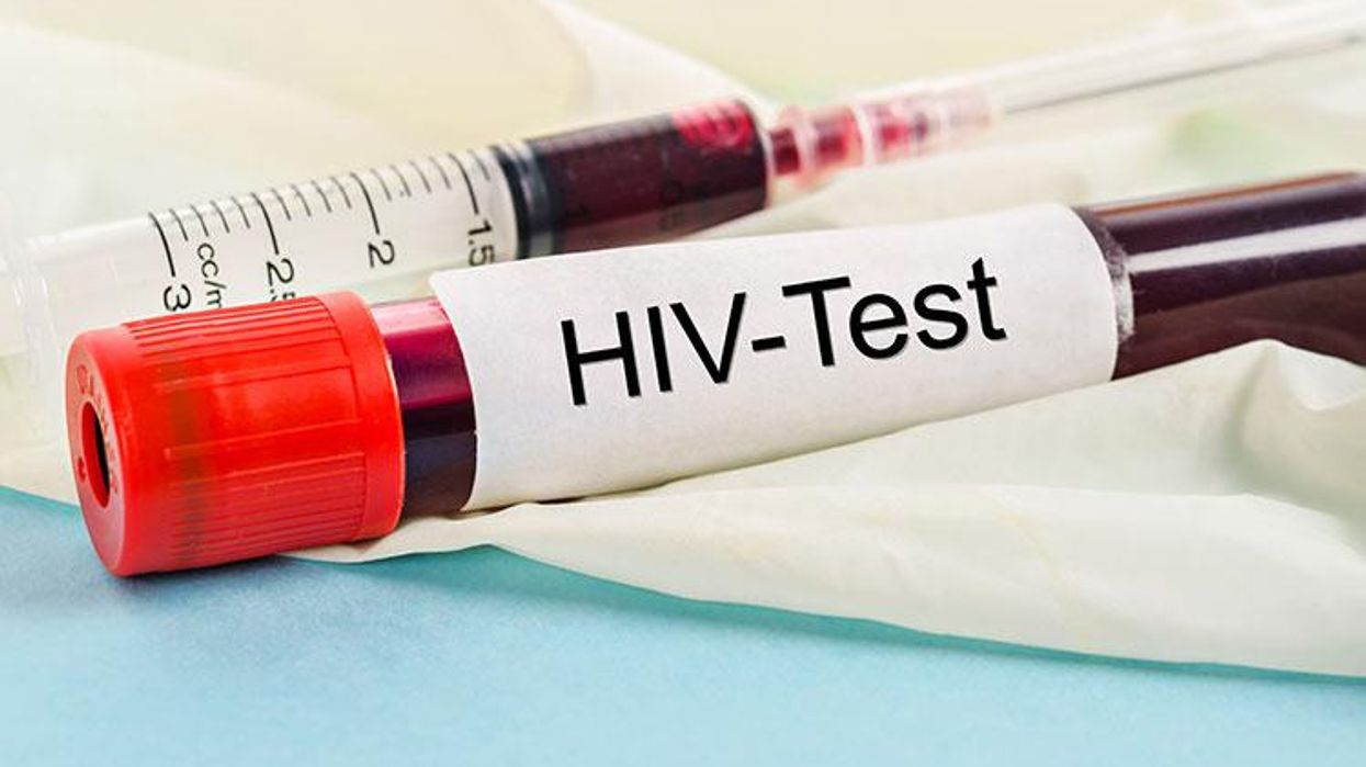 HIV 101: Is It Possible I Got a False Positive on My HIV Test?