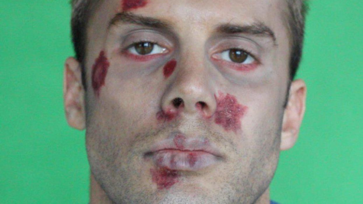 <p>YouTuber Tyler Curry Reveals the Face of HIV</p>