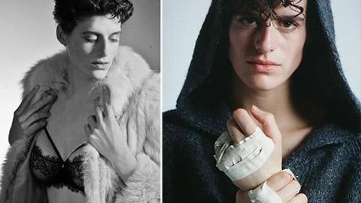 <p>Model Rain Dove Proves It's Always Better To Be 'Unapologetically You'</p>