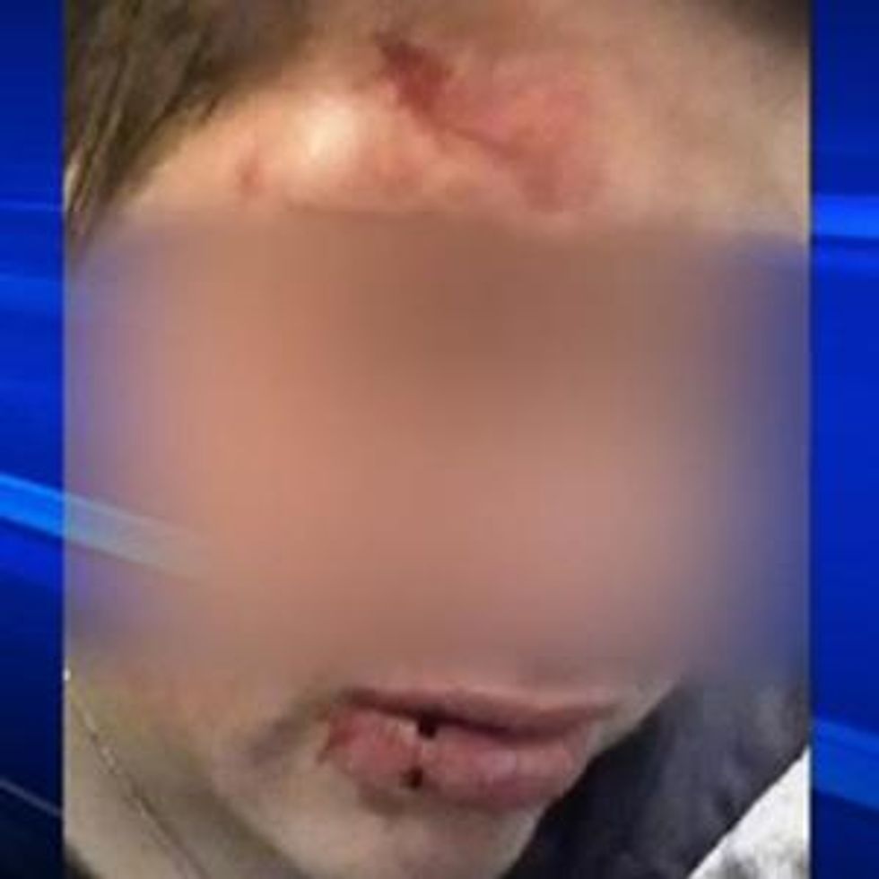 Teenage Lesbian Attacked In Canada, Police Consider Hate Crime