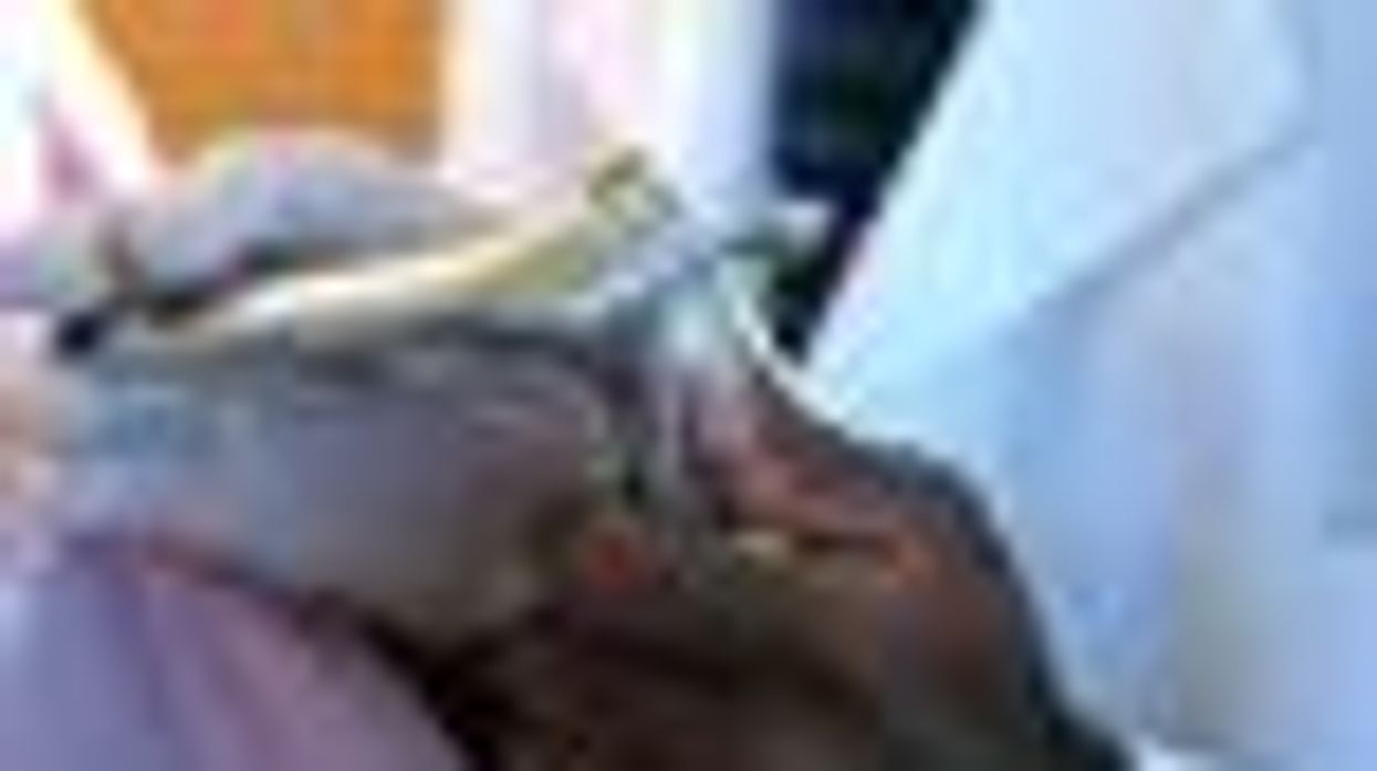 Op-Ed: Lesbians and the Fear of Forceps