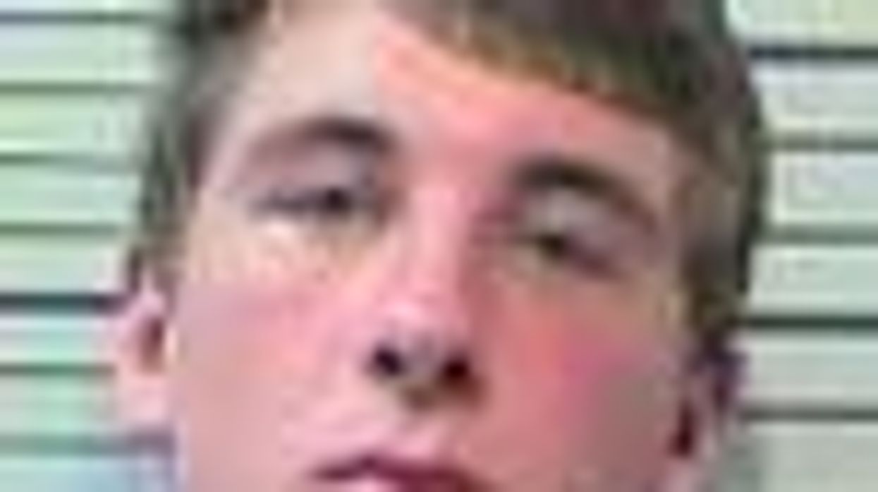 Young Alabama Lesbian Denies Brutal Thanksgiving Day Beating Was a Hate Crime