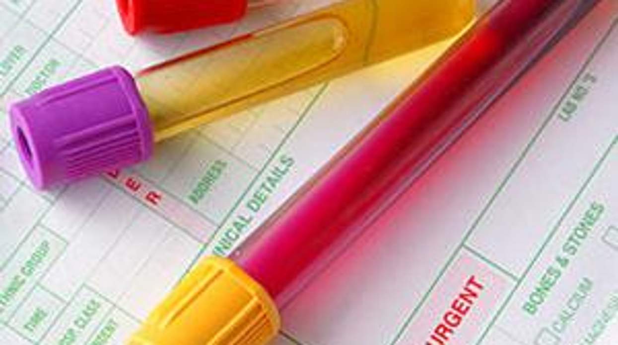 Lesbians Aren't Getting Screened for Cervical Cancer
