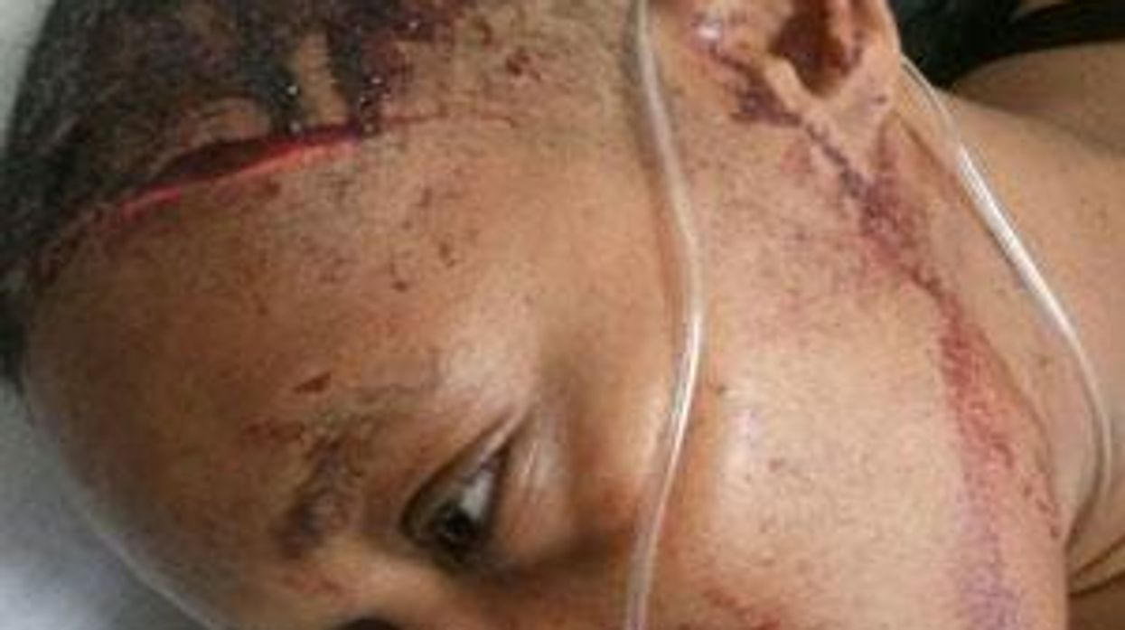 Oklahoma Lesbian Attacked, Victim Claims Attempted Murder