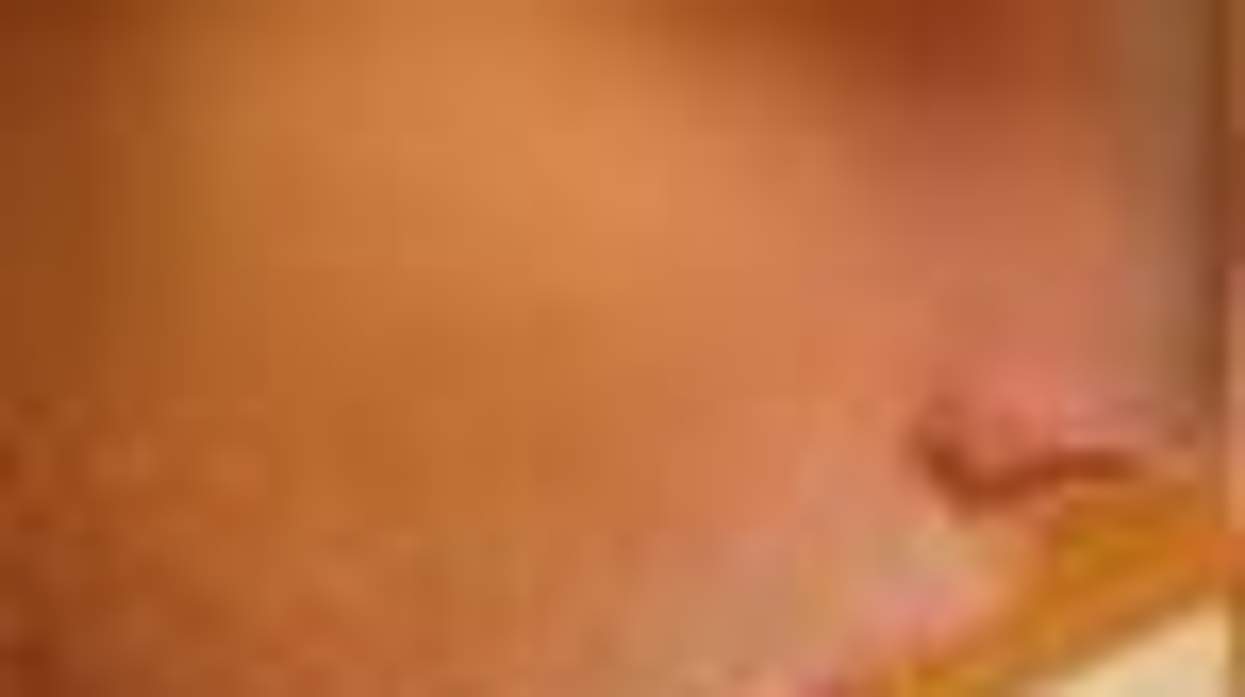 16-Year-Old Lesbian Brutally Beaten By Group of Men in Kentucky