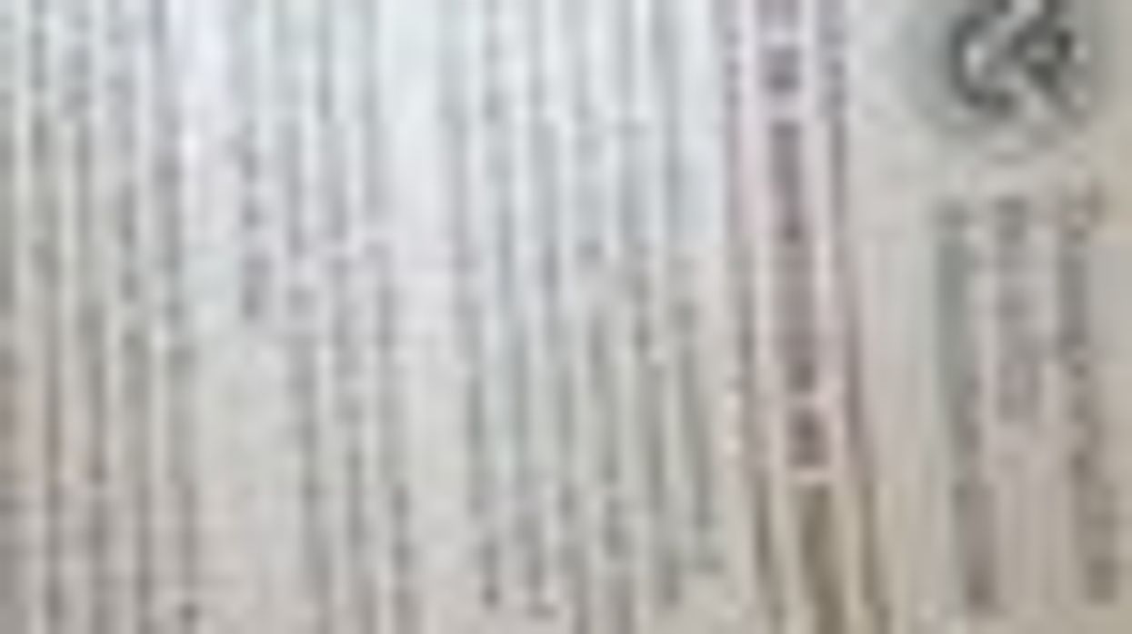 Is the TSA Pro-Vibrator?