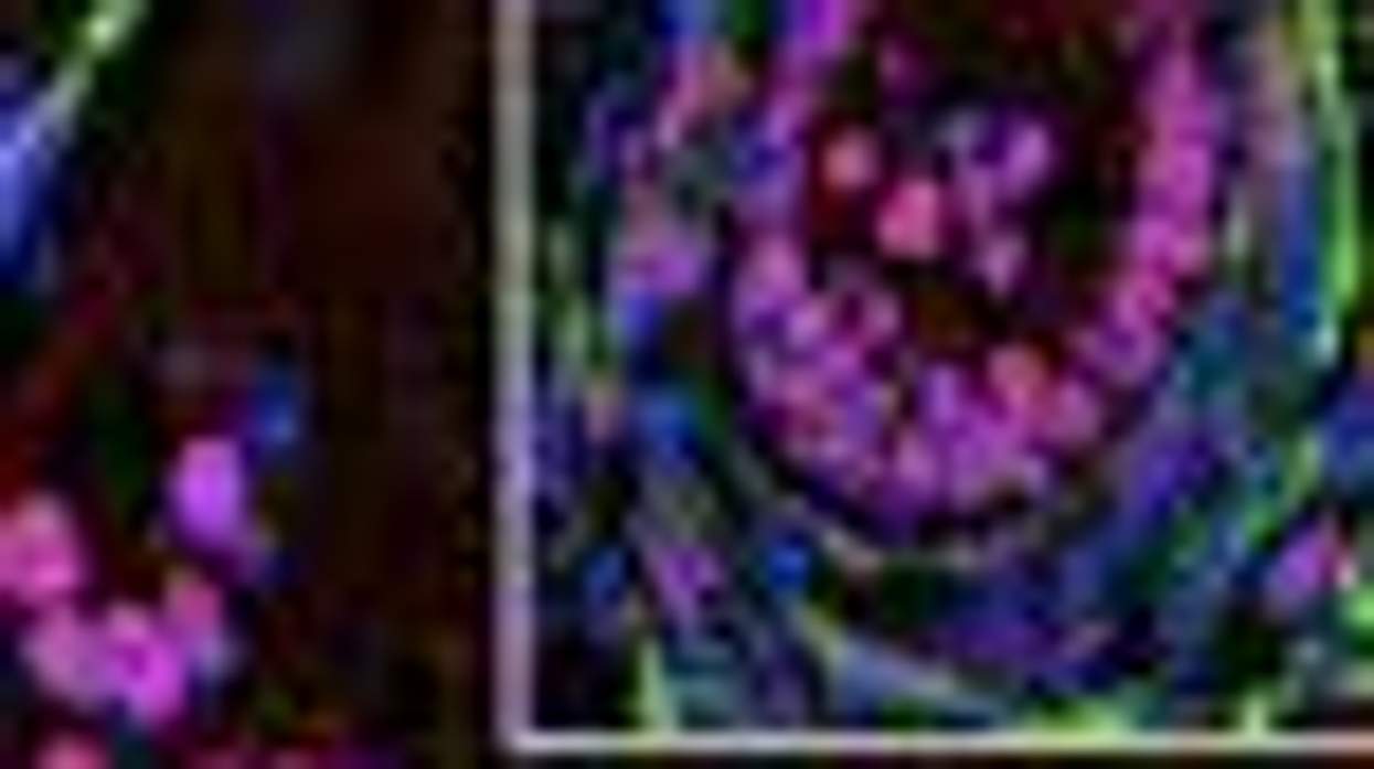 Sex Change Gene Discovered