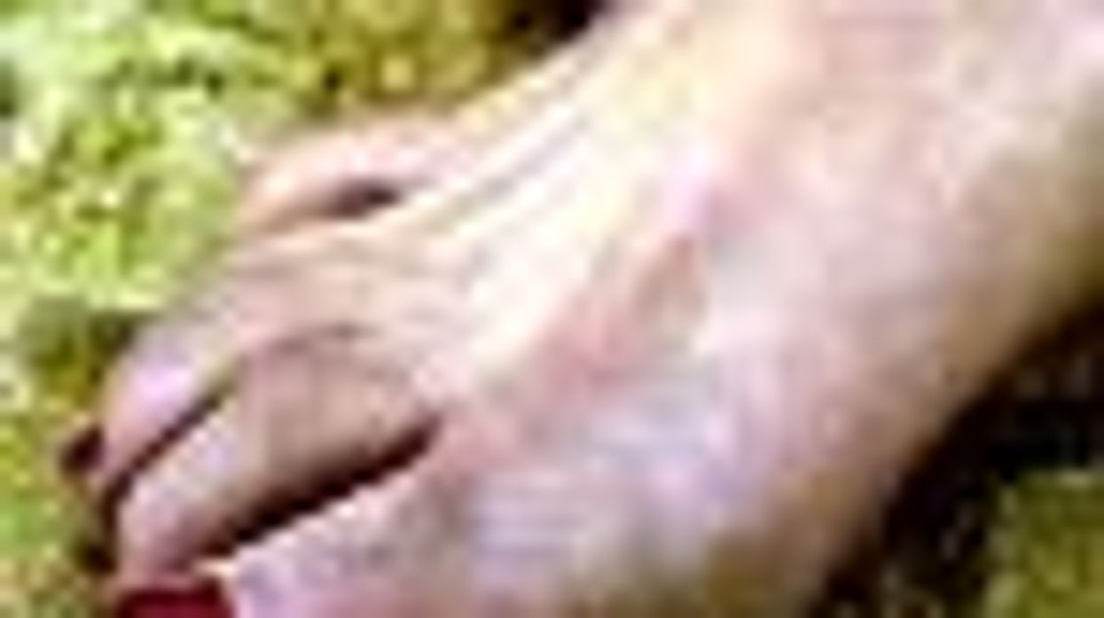 NBC on SheWired: Woman Rescued After Typing With Toes - Video