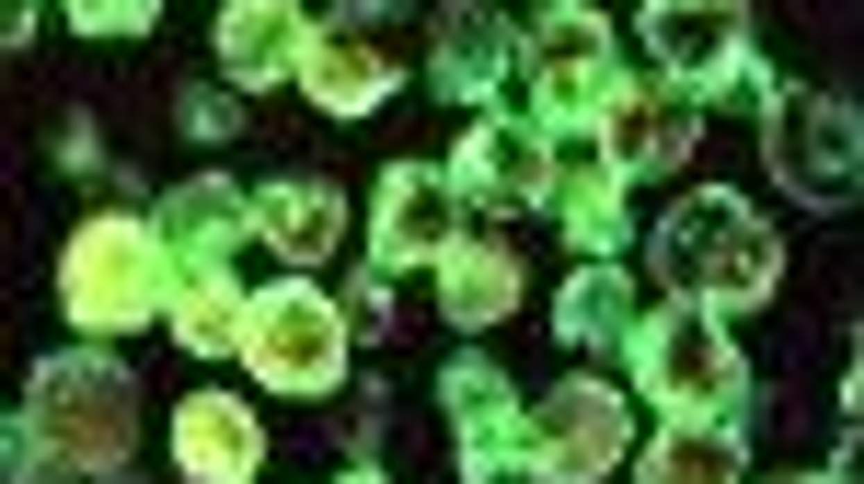 NBC on SheWired: Key to Weight Loss: Go With Your Gut - Video