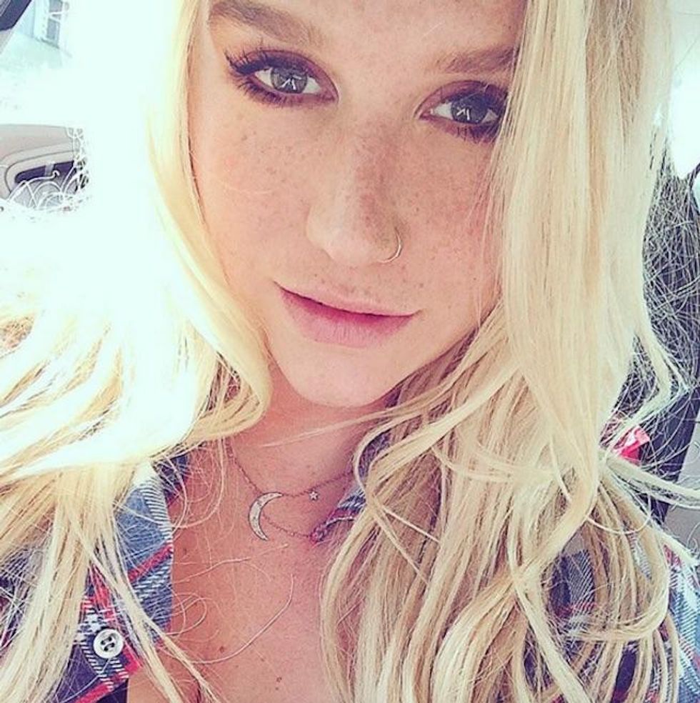Kesha