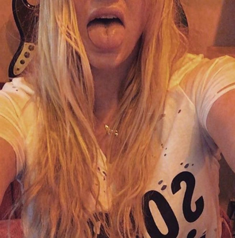 Kesha